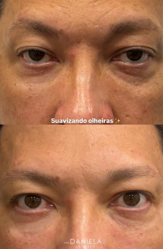 rejuvepro-3.jpg